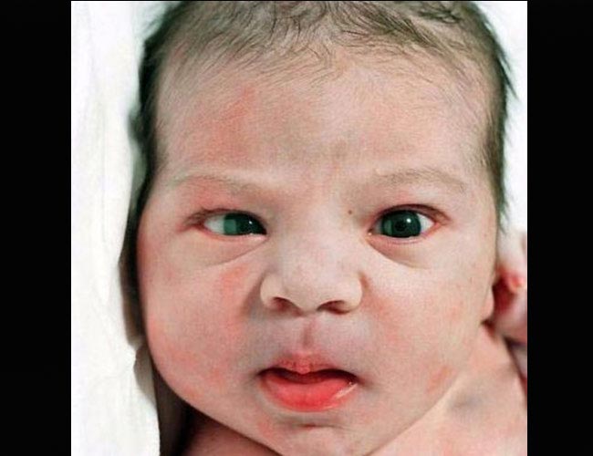 Giống như tất cả các cơ trong cơ thể, trẻ sơ sinh chưa có khả năng hoàn toàn kiểm soát cơ mắt của mình. Sẽ có lúc mẹ thấy bé nhìn thẳng vào mẹ. Lại có lúc, hai mắt của bé như đi theo hai hướng khác nhau. Đó là điều hoàn toàn bình thường.  Phải mất 4 tháng, hai mắt của bé mới hoàn toàn có thể hoạt động nhất quán.
