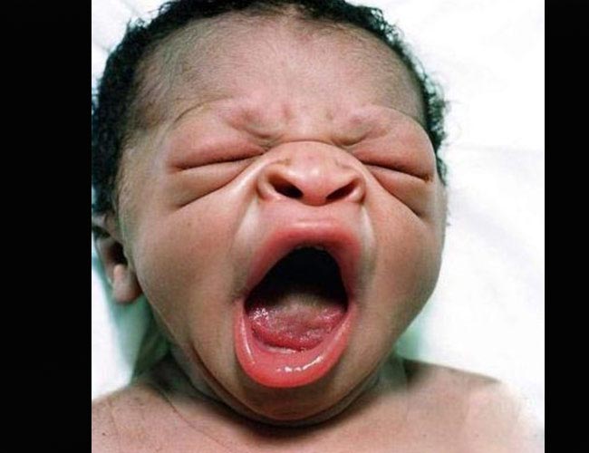 Trẻ sẽ khóc rất to khi mới chào đời để lấy không khí vào phổi
