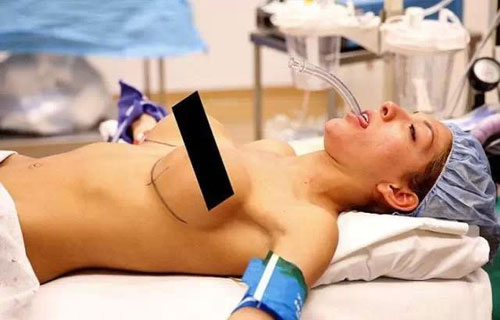 THẨM MỸ NÂNG NGỰC MANG ĐẾN VÒNG MỘT ĐẦY ĐẶN GIÚP CHỊ EM TỰ TIN HƠN TRONG CUỘC SỐNG