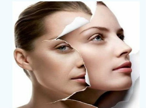 Căng bóng da mặt đón tết: Nên hay không? - 2