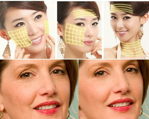 Căng bóng da mặt đón tết: Nên hay không? - 3