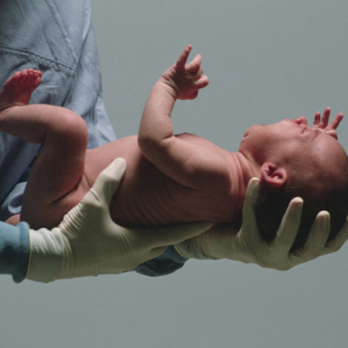 quot;Phanh phuiquot; 6 sự thật thú vị về làn da trẻ sơ sinh - 1