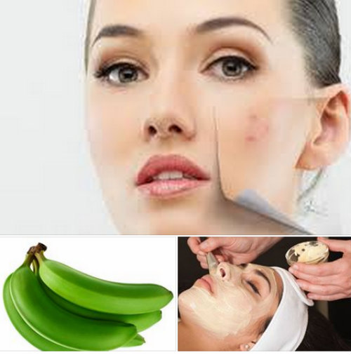 Chiêu độc trị mụn nhanh chóng đón Tết - 1