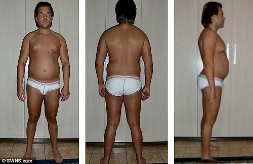 Quý ông nghiện thẩm mỹ chi tiền khủng để giống búp bê Ken - 5