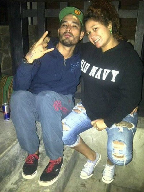 Bủn rủn với mốt cấy ghép dưới da để giống ‘thần tượng’ - 2