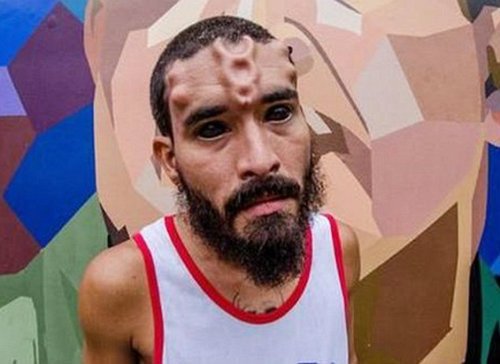 Bủn rủn với mốt cấy ghép dưới da để giống ‘thần tượng’ - 3