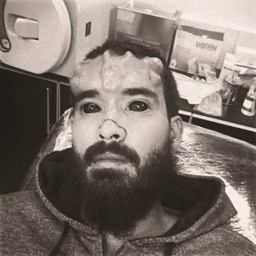 Bủn rủn với mốt cấy ghép dưới da để giống ‘thần tượng’ - 4