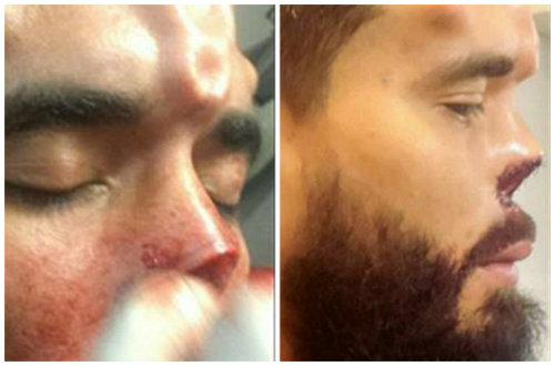 Bủn rủn với mốt cấy ghép dưới da để giống ‘thần tượng’ - 5