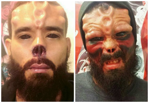 Bủn rủn với mốt cấy ghép dưới da để giống ‘thần tượng’ - 7