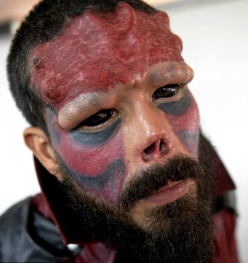 Bủn rủn với mốt cấy ghép dưới da để giống ‘thần tượng’ - 1