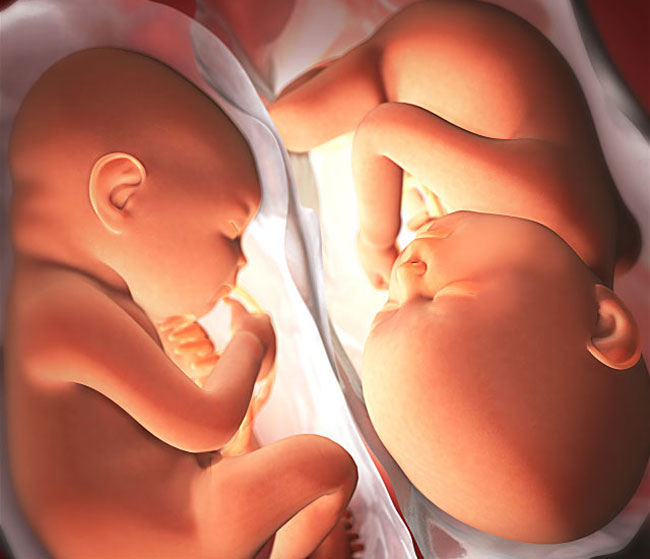 Tuần 31: Với mẹ mang bầu đơn thai thì tử cung vẫn còn khá rộng rãi nhưng với mẹ mang bầu song thai thì các bé đã cảm thấy khá chật chội. Lúc này, mỗi bé đã nặng khoảng 1,5kg.
