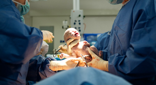 Những lợi ích khiến nhiều mẹ “mê mẩn” sinh mổ - 1