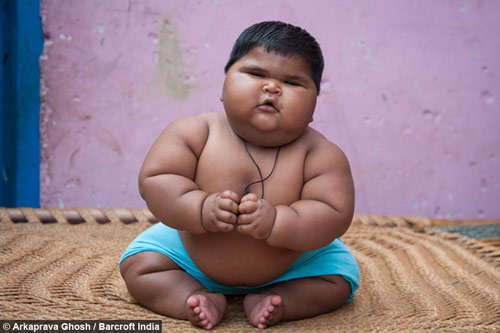 Tăng cân vùn vụt, bé 10 tháng nặng 18,7kg - 2