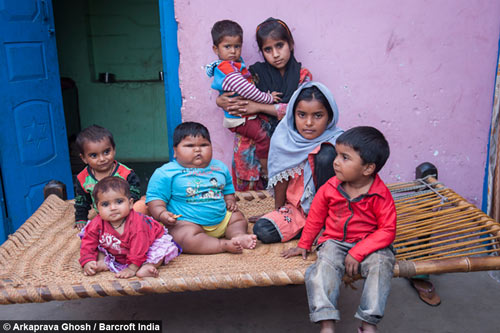 Tăng cân vùn vụt, bé 10 tháng nặng 18,7kg - 3