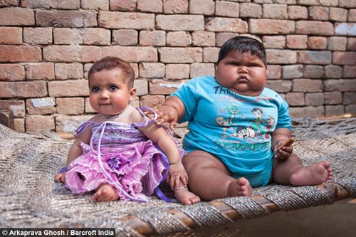 Tăng cân vùn vụt, bé 10 tháng nặng 18,7kg - 1