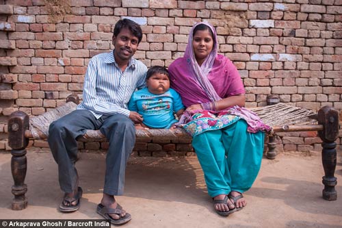 Tăng cân vùn vụt, bé 10 tháng nặng 18,7kg - 4