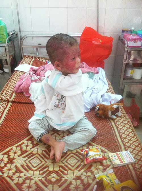 Bà mẹ bán bóng bay và đứa con lở loét gây xót xa dân mạng - 2