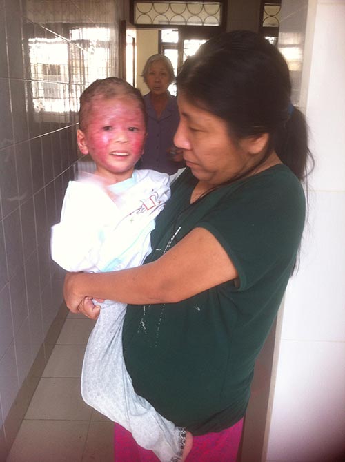 Bà mẹ bán bóng bay và đứa con lở loét gây xót xa dân mạng - 4