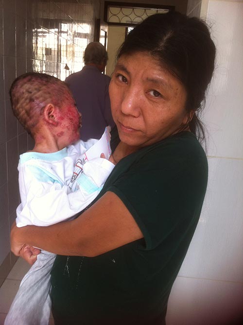 Bà mẹ bán bóng bay và đứa con lở loét gây xót xa dân mạng - 3