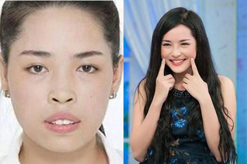 So độ #039;lột xác#039; của 10 thiếu nữ Việt sau dao kéo - 9
