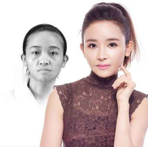 So độ #039;lột xác#039; của 10 thiếu nữ Việt sau dao kéo - 7