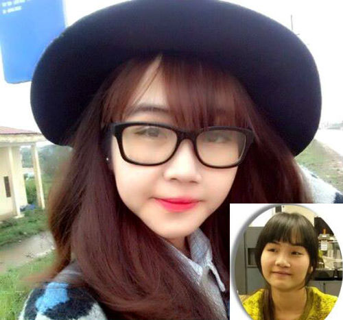 So độ #039;lột xác#039; của 10 thiếu nữ Việt sau dao kéo - 6