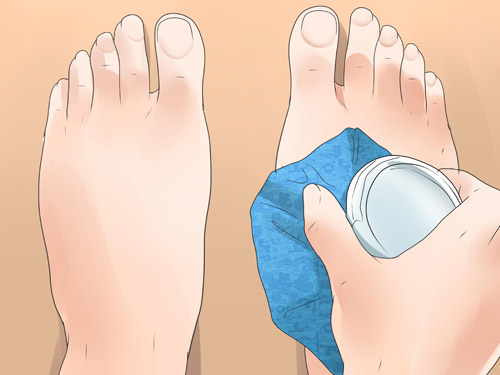 Mẹo nhỏ giúp mẹ bầu hết phù nề - 5