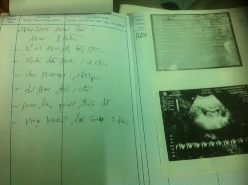 Ròng rã 3 năm một mình đi chữa vô sinh - 2