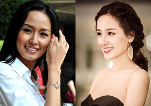 Nhan sắc người nổi tiếng trước và sau khi sửa răng - 14