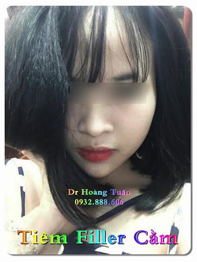 Phái đẹp Hà thành #039;đổ xô#039; đi làm đẹp không dao kéo dịp cuối năm - 5