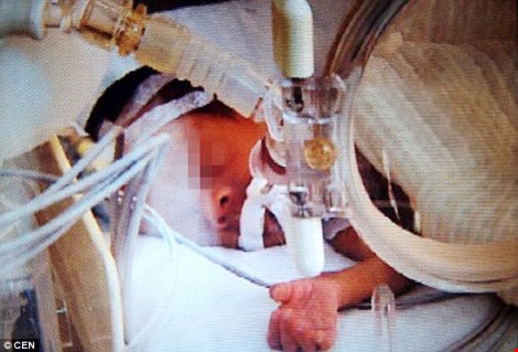 Đứa bé #039;chết đi sống lại#039; sau 15 tiếng trong phòng lạnh âm 12 độ - 1