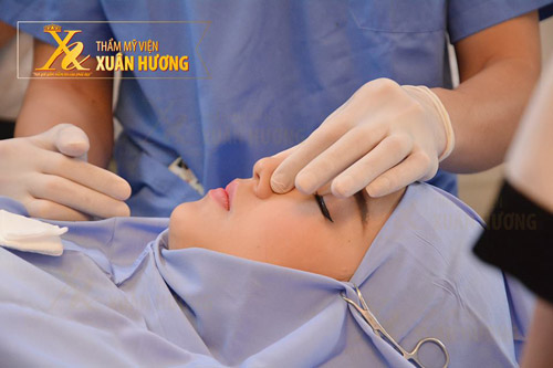 Mũi cao có phải là mũi đẹp? - 1