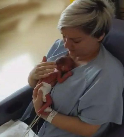 Khoảnh khắc rơi lệ của mẹ lần đầu ôm con sinh non - 1