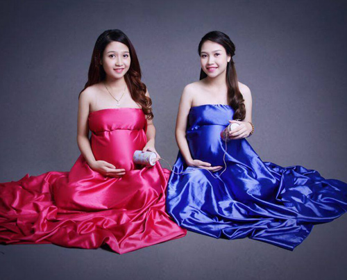Chuyện vượt cạn cùng ngày kỳ lạ của cặp song sinh ở HN - 3
