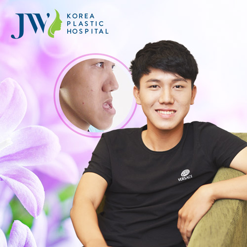 Cơ hội miễn phí phẫu thuật hàm hô móm không cần niềng răng - 3