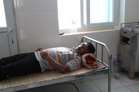 Lâm tặc đánh trọng thương kiểm lâm để giải vây gỗ lậu - 1