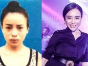 Tin tức - Hot girl phẫu thuật trốn truy nã bị bắt khi đang tổ chức sinh nhật kỳ dị