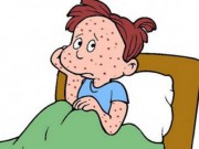 Sức khỏe - Đang mùa thủy đậu, bài thuốc từ rau mùi mẹ cần biết trị bệnh cho con, không cần thuốc tây