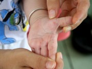 Sức khỏe - Dấu hiệu bệnh tay chân miệng ở trẻ, mẹ nhất định phải biết