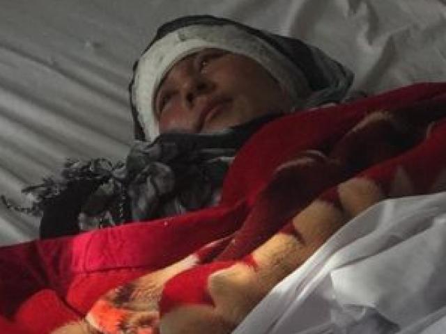 Kinh hoàng người vợ 23 tuổi bị chồng trói tay chân rồi cắt đứt cả 2 tai