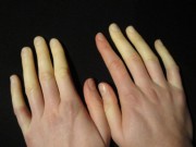 Sức khỏe - Dấu hiệu cơ thể cảnh báo bệnh nguy hiểm bạn nhất định phải đi khám ngay