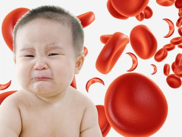 “Đau khổ” vì con nhà giàu lại thiếu sắt, thiếu máu