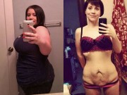 Bà bầu - Thấy vợ từ chối gần gũi vì 'bụng che cả vùng kín', chồng chi ngay 200 triệu để phẫu thuật