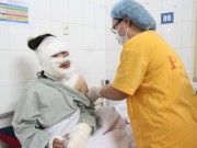 Tin tức - Nếu muốn tránh nguy cơ bị nát mặt, mù mắt, đừng cho trẻ chơi loại bóng bay phát nổ