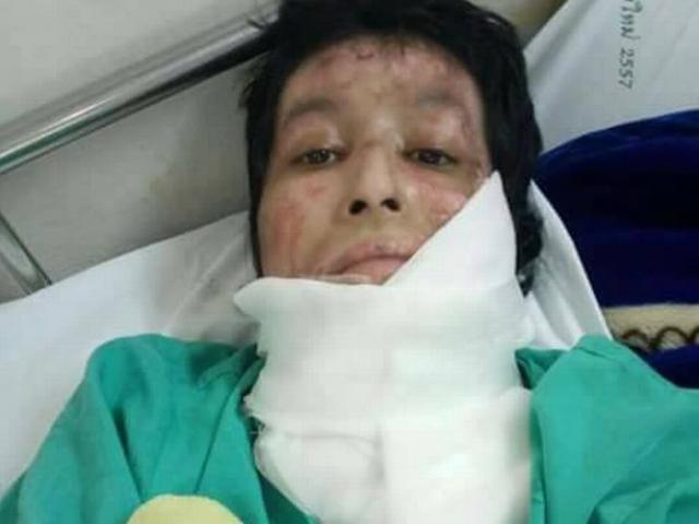 Lời kêu cứu của bà vợ bị chồng đổ xăng vào người đốt cháy như ngọn đuốc