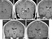 Tin tức - Bị giun đũa làm tổ trong não vì thói quen nuôi chó mèo, ăn rau sống không đúng