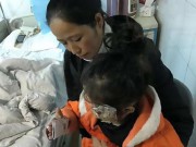 Tin tức - Bé 4 tuổi bị biến dạng vĩnh viễn gương mặt vì thói quen dùng điện thoại của bố
