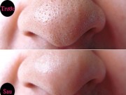 Làm đẹp - Lột sạch mụn cám, mụn đầu đen chỉ bằng nắm lá này xay nhuyễn