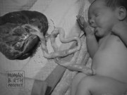 Bà bầu - Bé sơ sinh nằm mút ngón tay ngon lành cạnh dây rốn và nhau thai hút 3 triệu lượt xem