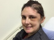 Sức khỏe - Tưởng chỉ đau đầu bình thường, hóa ra bị... u não